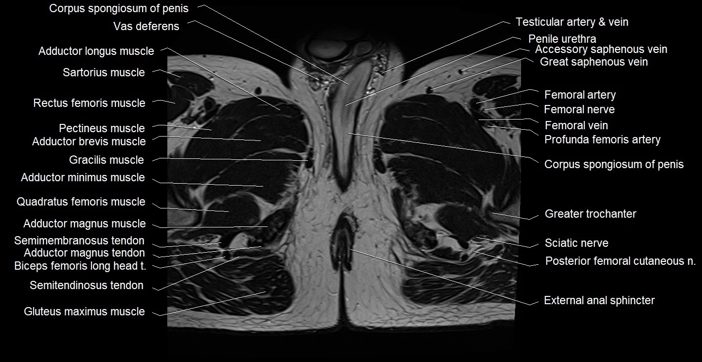 Male pelvis axial cross sectional anatomy image 47.webp